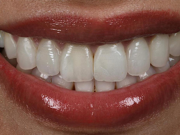 Hochwertiger Zahnersatz — gefertigt im Dentallabor