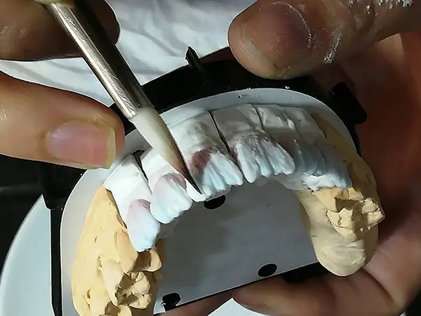 Zahntechniker bei der Präzisionsarbeit im Dentallabor